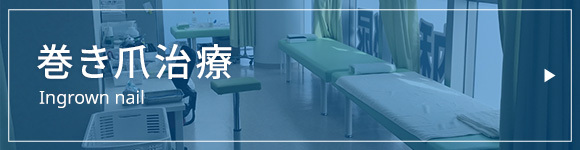 巻き爪治療